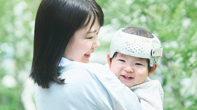 ベビーバンド｜ヘルメット治療で赤ちゃんの頭のゆがみを矯正